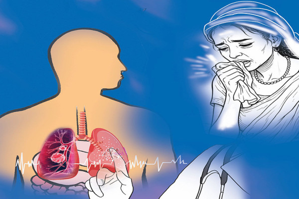 गरिबीसँगै मौलाएको क्षयरोग